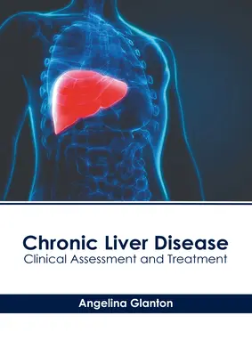 Malattia epatica cronica: Valutazione clinica e trattamento - Chronic Liver Disease: Clinical Assessment and Treatment