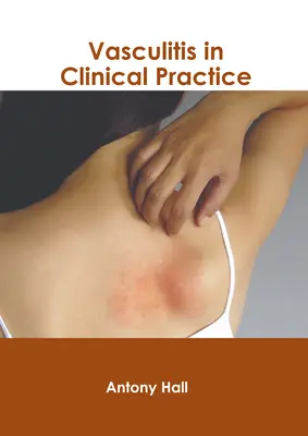Vasculite nella pratica clinica - Vasculitis in Clinical Practice
