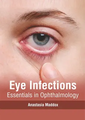 Infezioni oculari: Elementi essenziali di oftalmologia - Eye Infections: Essentials in Ophthalmology