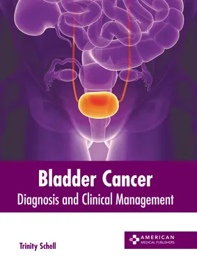 Cancro della vescica: Diagnosi e gestione clinica - Bladder Cancer: Diagnosis and Clinical Management