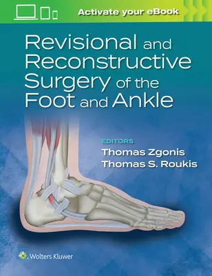 Chirurgia ricostruttiva del piede e della caviglia - Revisional and Reconstructive Surgery of the Foot and Ankle