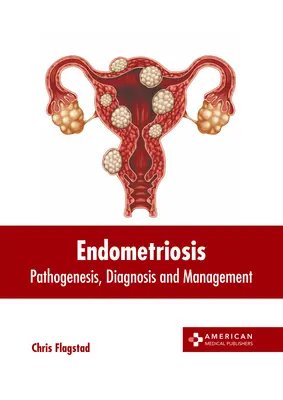 Endometriosi: Patogenesi, diagnosi e gestione - Endometriosis: Pathogenesis, Diagnosis and Management