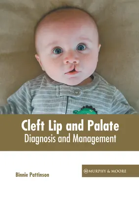 Labiopalatoschisi: Diagnosi e gestione - Cleft Lip and Palate: Diagnosis and Management