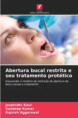 Abertura bucale restrita e trattamento prottico - Abertura bucal restrita e seu tratamento prottico