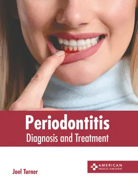 Parodontite: Diagnosi e trattamento - Periodontitis: Diagnosis and Treatment