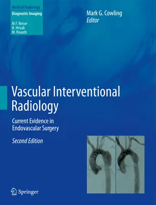 Radiologi Intervensi Vaskular: Bukti Terkini dalam Bedah Endovaskular - Vascular Interventional Radiology: Current Evidence in Endovascular Surgery