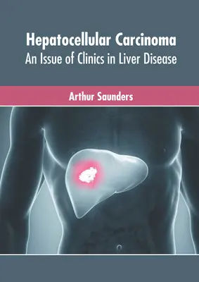 Carcinoma epatocellulare: un numero delle Cliniche delle malattie del fegato - Hepatocellular Carcinoma: An Issue of Clinics in Liver Disease