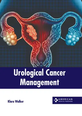 Gestione del cancro urologico - Urological Cancer Management