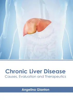 Malattia epatica cronica: Cause, valutazione e terapia - Chronic Liver Disease: Causes, Evaluation and Therapeutics