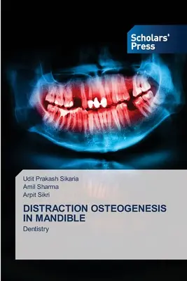 Osteogenesi da distrazione nella mandibola - Distraction Osteogenesis in Mandible