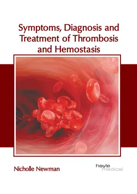 Sintomi, diagnosi e trattamento della trombosi e dell'emostasi - Symptoms, Diagnosis and Treatment of Thrombosis and Hemostasis