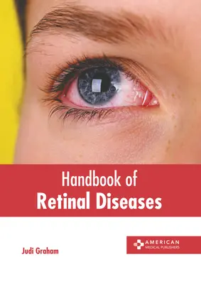 Manuale delle malattie della retina - Handbook of Retinal Diseases