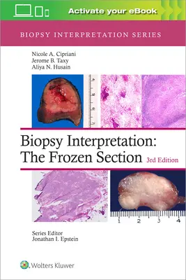 Interpretazione della biopsia: La sezione congelata - Biopsy Interpretation: The Frozen Section
