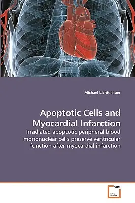 Cellule apoptotiche e infarto miocardico - Apoptotic Cells and Myocardial Infarction