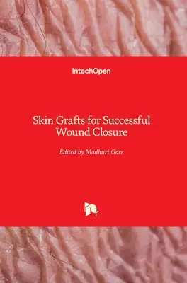 Innesti cutanei per il successo della chiusura delle ferite - Skin Grafts for Successful Wound Closure