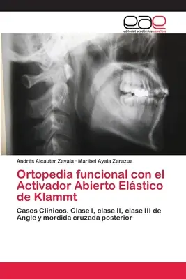 Ortopedia funzionale con l'Attivatore Abierto Elstico di Klammt - Ortopedia funcional con el Activador Abierto Elstico de Klammt