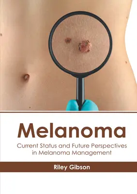 Melanoma: Stato attuale e prospettive future nella gestione del melanoma - Melanoma: Current Status and Future Perspectives in Melanoma Management
