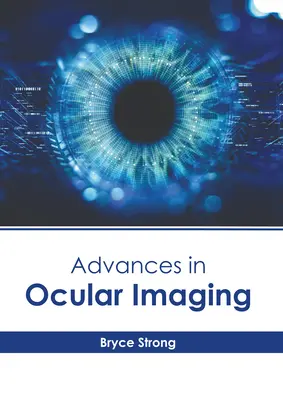 I progressi dell'imaging oculare - Advances in Ocular Imaging