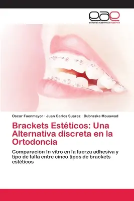 Parentesi graffe: Un'alternativa discreta all'ortodonzia - Brackets Estticos: Una Alternativa discreta en la Ortodoncia