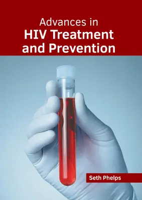 I progressi nel trattamento e nella prevenzione dell'HIV - Advances in HIV Treatment and Prevention