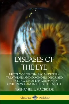 Malattie dell'occhio: storia della medicina oftalmica - Trattamenti e diagnosi descritti da un chirurgo e professore di oftalmologia nel Regno Unito. - Diseases of the Eye: History of Ophthalmic Medicine - Treatments and Diagnoses Described by a Surgeon and Professor of Ophthalmology in the
