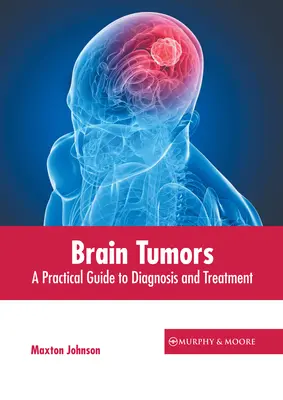 Tumori cerebrali: Guida pratica alla diagnosi e al trattamento - Brain Tumors: A Practical Guide to Diagnosis and Treatment