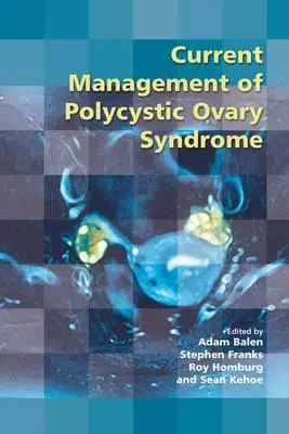 Gestione attuale della sindrome dell'ovaio policistico - Current Management of Polycystic Ovary Syndrome