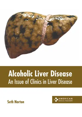 Malattia epatica alcolica: Un numero delle Cliniche delle malattie del fegato - Alcoholic Liver Disease: An Issue of Clinics in Liver Disease