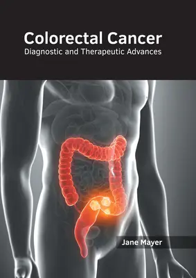 Cancro del colon-retto: I progressi diagnostici e terapeutici - Colorectal Cancer: Diagnostic and Therapeutic Advances