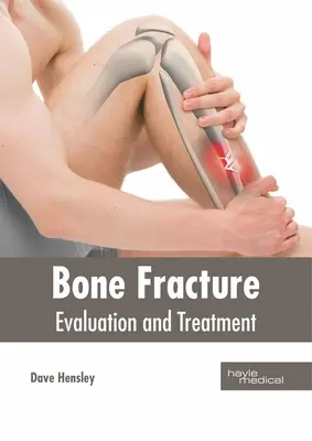 Frattura ossea: Valutazione e trattamento - Bone Fracture: Evaluation and Treatment