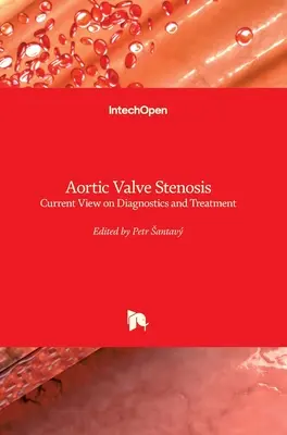 Stenosi della valvola aortica: Attualità della diagnosi e del trattamento - Aortic Valve Stenosis: Current View on Diagnostics and Treatment