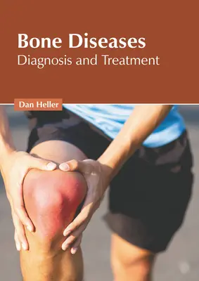 Malattie delle ossa: Diagnosi e trattamento - Bone Diseases: Diagnosis and Treatment