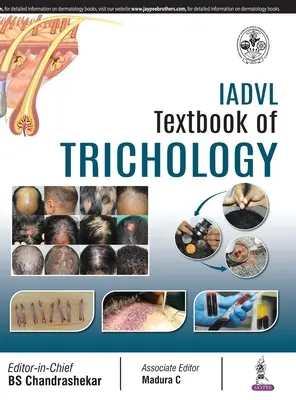 Libro di testo di tricologia della IADVL - IADVL Textbook of Trichology