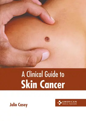 Guida clinica al cancro della pelle - A Clinical Guide to Skin Cancer