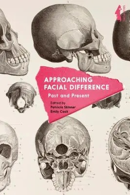 Approccio alla differenza facciale: Passato e presente - Approaching Facial Difference: Past and Present