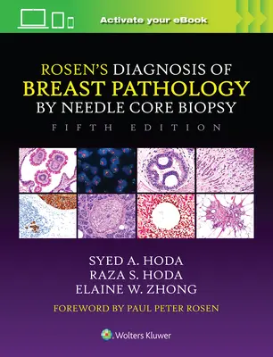 Diagnosi di Rosen della patologia mammaria mediante agobiopsia del nucleo - Rosen's Diagnosis of Breast Pathology by Needle Core Biopsy