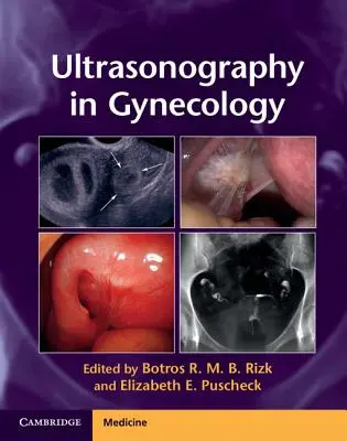 Ultrasonografia in ginecologia - Ultrasonography in Gynecology