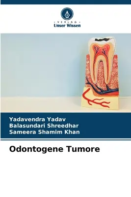 Tumore di Odontogene - Odontogene Tumore