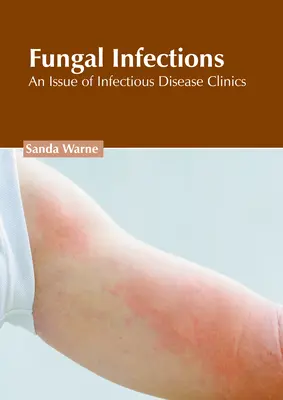 Infezioni fungine: Un numero di Cliniche di Malattie Infettive - Fungal Infections: An Issue of Infectious Disease Clinics