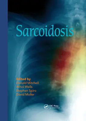 Sarcoidosi - Sarcoidosis