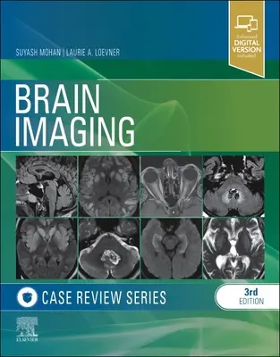 Rassegna di casi di imaging cerebrale - Brain Imaging Case Review