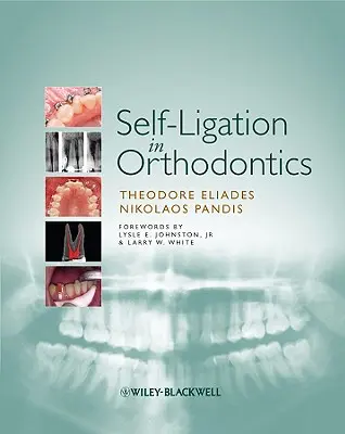 L'autolegatura in ortodonzia: Un approccio alla biomeccanica e al trattamento basato sull'evidenza - Self-Ligation in Orthodontics: An Evidence-Based Approach to Biomechanics and Treatment