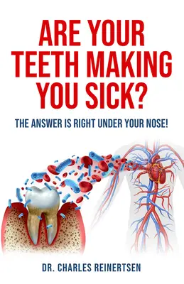 I denti vi fanno ammalare: la risposta è proprio sotto il vostro naso - Are Your Teeth Making You Sick?: The Answer Is Right Under Your Nose