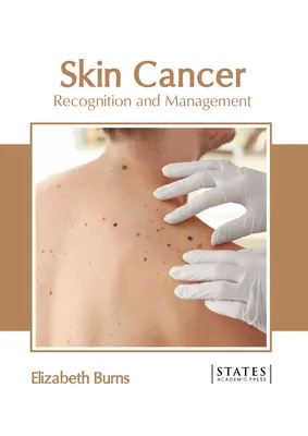Cancro della pelle: Riconoscimento e gestione - Skin Cancer: Recognition and Management