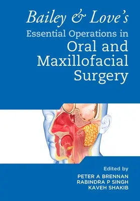 Operazioni essenziali in chirurgia orale e maxillo-facciale di Bailey e Love - Bailey & Love's Essential Operations in Oral & Maxillofacial Surgery