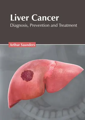 Cancro del fegato: Diagnosi, prevenzione e trattamento - Liver Cancer: Diagnosis, Prevention and Treatment