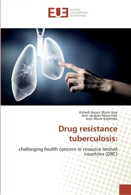 La resistenza ai farmaci della tubercolosi - Drug resistance tuberculosis
