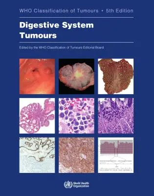 Tumori dell'apparato digerente: Chi classifica i tumori - Digestive System Tumours: Who Classification of Tumours