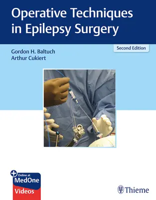 Tecniche operative nella chirurgia dell'epilessia - Operative Techniques in Epilepsy Surgery
