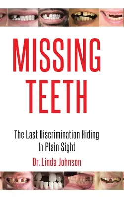 Denti mancanti: L'ultima discriminazione che si nasconde sotto gli occhi di tutti - Missing Teeth: The Last Discrimination Hiding in Plain Sight